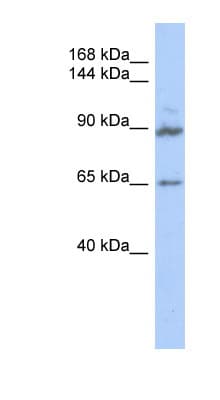 Polyclonal Rabbit anti-Human GASP2 / GPRASP2 Antibody (aa539-588, WB)