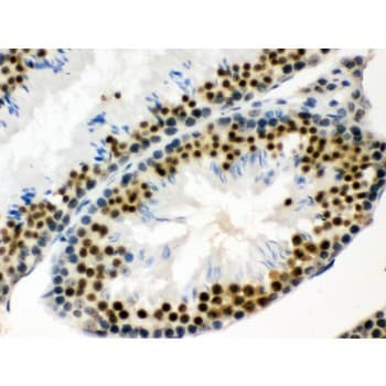 EWSR1 / EWS Antibody (aa369-399)