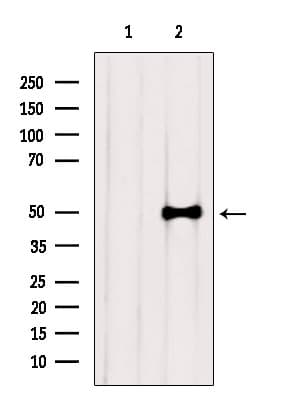 RARG / RAR-Gamma Antibody