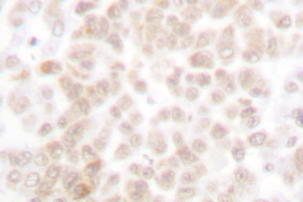 FOSL2 / FRA-2 Antibody (Ser301)