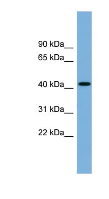 WDFY1 Antibody (N-Terminus)
