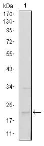SNAI1 / SNAIL-1 Antibody (clone 6D2)
