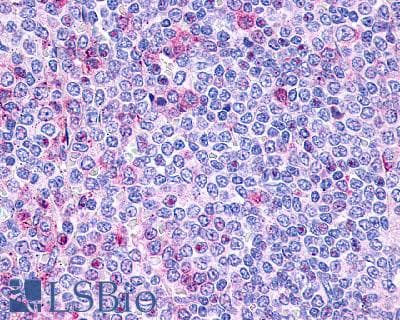 IHC-plus™ Polyclonal Rabbit anti-Human P2Y10 / P2RY10 Antibody (Extracellular Domain, IHC)
