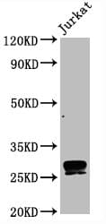 CD99 Antibody