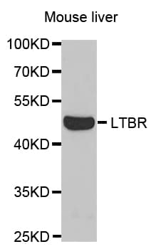 IHC-plus™ LTBR Antibody