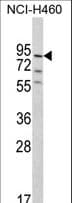 PLEKHG6 Antibody (aa60-87)