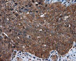HMRF1L / MTRF1L Antibody (clone OTI1D11)