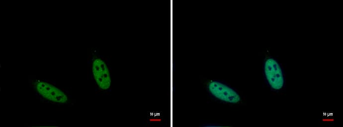 Polyclonal Rabbit anti-Human NPM1 / NPM / Nucleophosmin Antibody (aa1-209, IHC, IF)