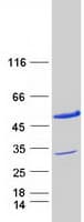 Human PDCD2L Protein (Recombinant Myc-DDK (Flag))