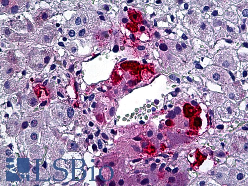 IHC-plus™ Polyclonal Rabbit anti-Human TH / Tyrosine Hydroxylase Antibody (aa41-90, IHC, IF, WB)