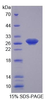 Human CDK16 / PCTAIRE Protein (Recombinant His-T7)