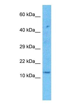 KRTAP2-1 Antibody (C-Terminus)