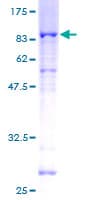 Human STK38L / NDR2 Protein (Recombinant GST)