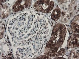 F13A1 / Factor XIIIa Antibody (clone 6F5, Carrier-free)