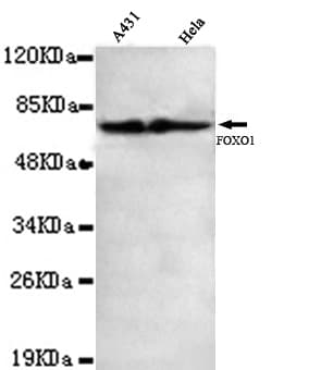 FOXO1 / FKHR Antibody