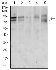 FOXP1 Antibody (clone 6E4)