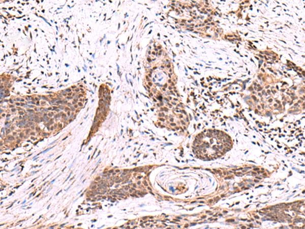 SCCPDH Antibody