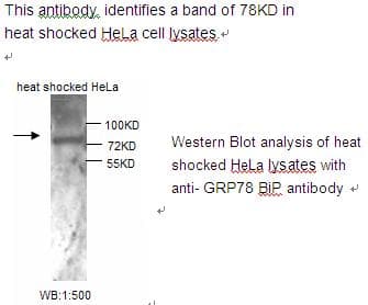 Polyclonal Rabbit anti-Human HSPA5 / GRP78 / BiP Antibody (WB)