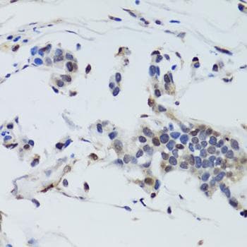 DNMT / DNMT1 Antibody