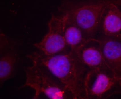 ER Alpha / Estrogen Receptor Antibody (phospho-Ser118)