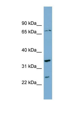 Polyclonal Rabbit anti-Human PDP2 Antibody (aa287-336, WB)
