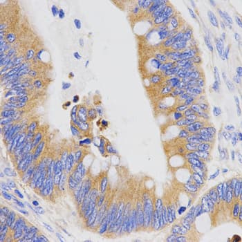 PGC / Pepsin C Antibody