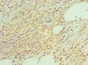 TAC1 Antibody (aa1-129)