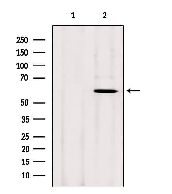 CYP26B1 Antibody