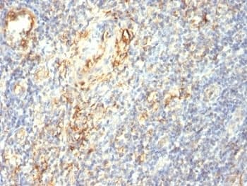 TGM2 / Transglutaminase 2 Antibody (clone TGM2/419)