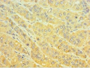 MTMR4 Antibody (aa570-820)
