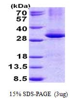 Human NAR / CPSF4 Protein (Recombinant His)