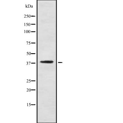 PNCK / CaMK1b Antibody