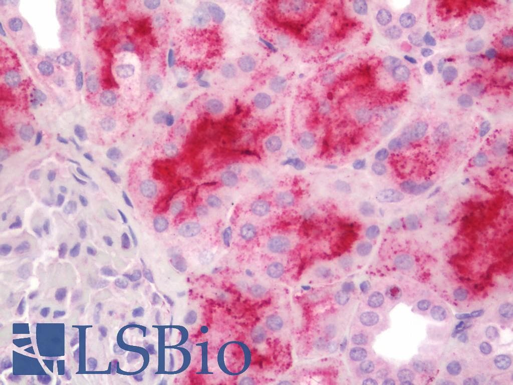IHC-plus™ Monoclonal Mouse anti-Human MAGEA3 Antibody (clone 1H1, IHC, WB)