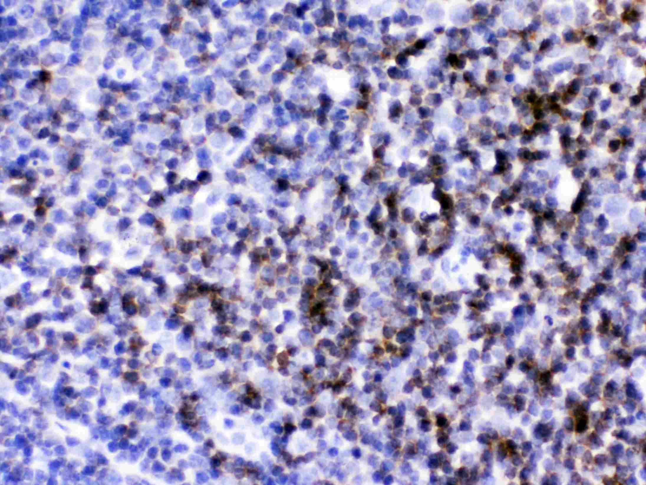 CD2 Antibody