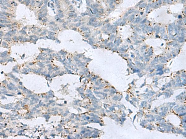 Polyclonal Rabbit anti-Human GPR6 Antibody (IHC, WB)