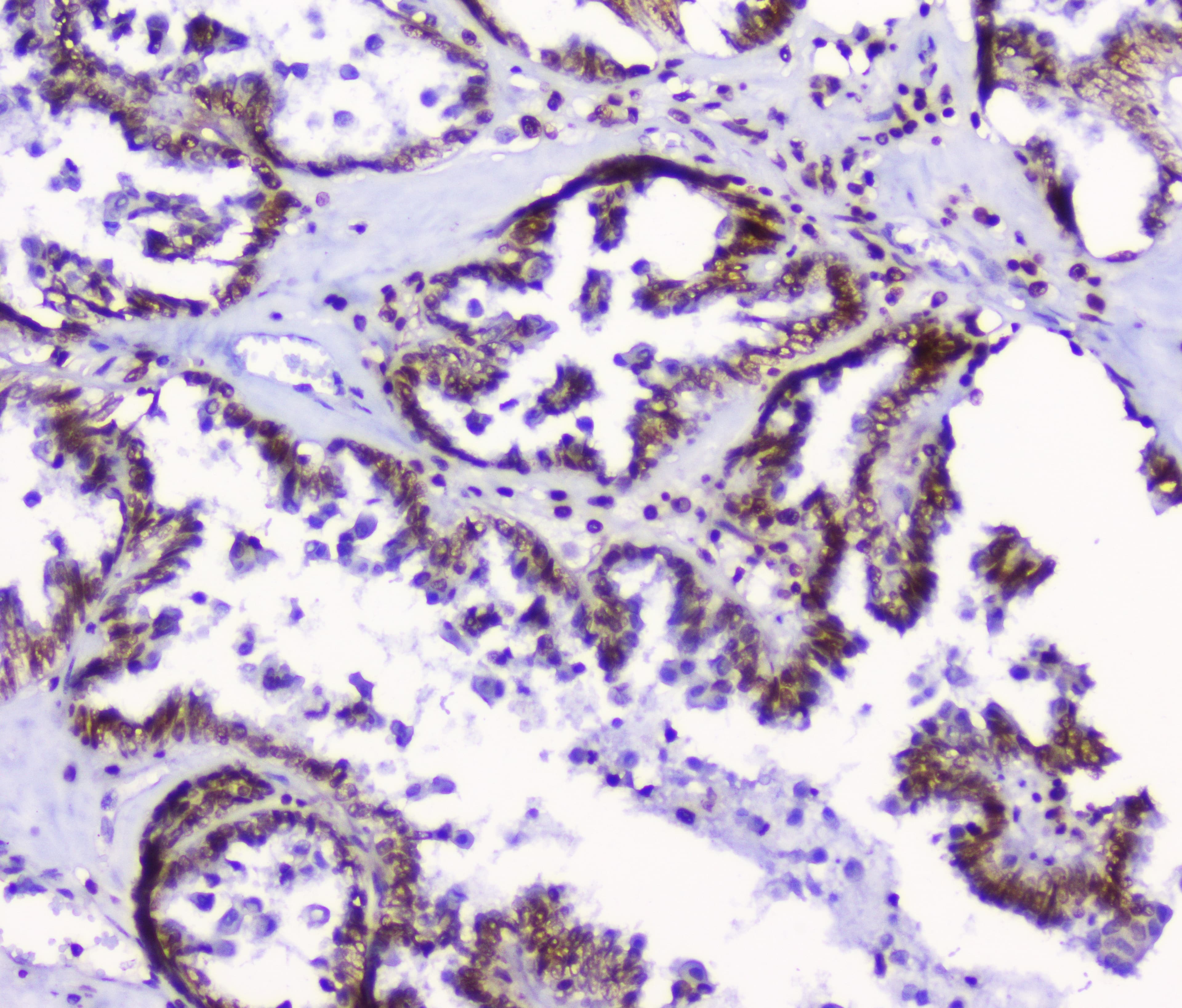 HMGN2 Antibody