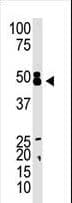 Polyclonal Rabbit anti-Human CBX8 Antibody (aa306-337, IHC, WB)