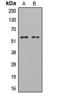 Polyclonal Rabbit anti-Human LYN Antibody (phospho-Tyr508, WB)