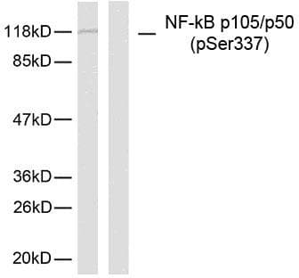 Polyclonal Rabbit anti-Human NFKB1 / NF-Kappa-B Antibody (phospho-Ser337, IHC, WB)