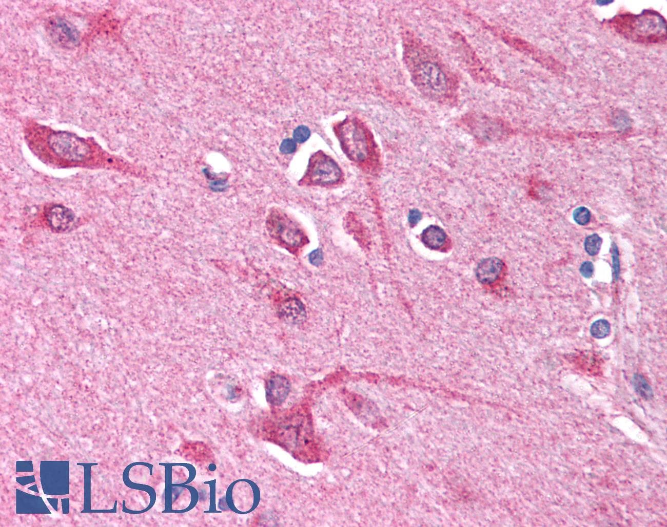 IHC-plus™ BCL10 / BCL-10 Antibody