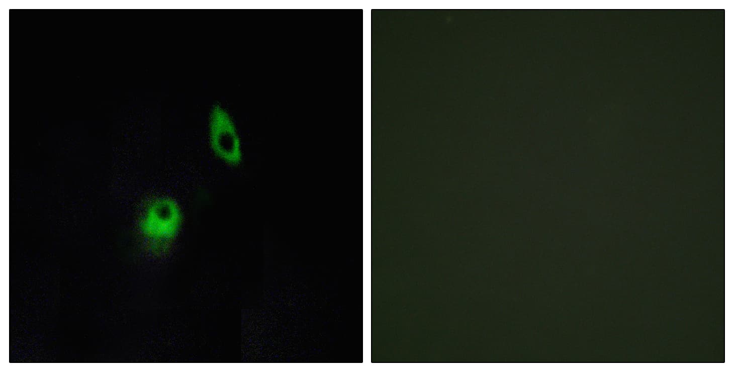 ADGRA2 / GPR124 Antibody (aa1151-1200)