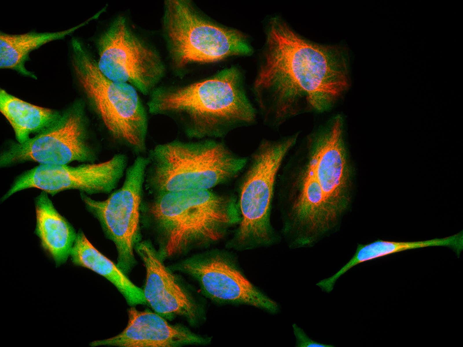 PathPlus™ Monoclonal Mouse anti-Human PARK7 / DJ-1 Antibody (clone 4H4, IHC, IF, WB)