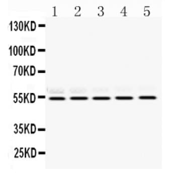 RBBP4 / RBAP48 Antibody (aa395-425)