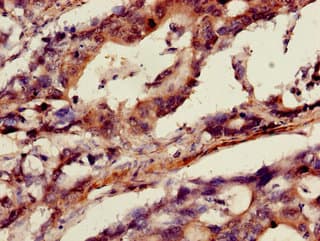 ANXA10 / Annexin A10 Antibody