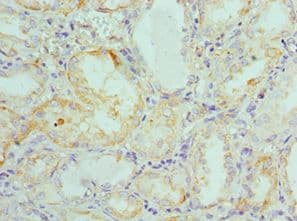 FGF1 / Acidic FGF Antibody (aa16-155)
