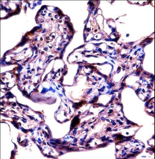 Polyclonal Rabbit anti-Human STS / ASC / Steroid Sulfatase Antibody (aa488-517, IHC, WB)
