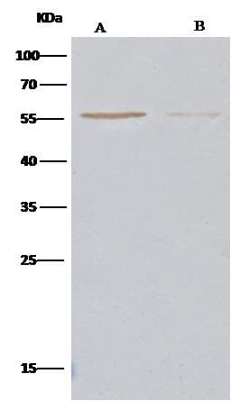TUBB3 / Tubulin Beta 3 Antibody (Preservative Free)
