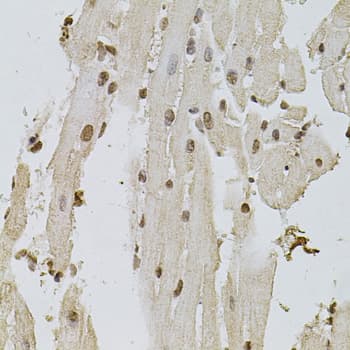 Polyclonal Rabbit anti-Human EGFR Antibody (IHC, IF, WB)