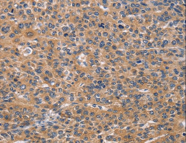 NCR2 / NKP44 Antibody