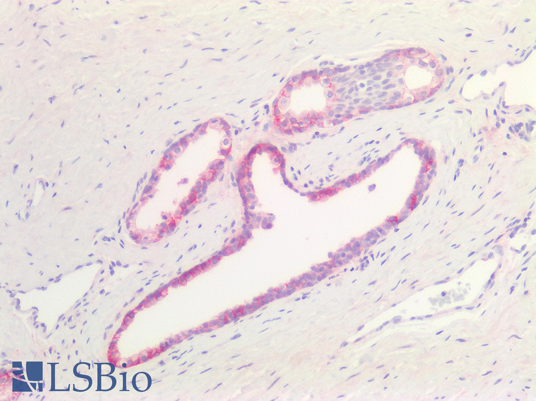 PathPlus™ Polyclonal Rabbit anti-Human CD276 / B7-H3 Antibody (aa47-219, IHC, WB)